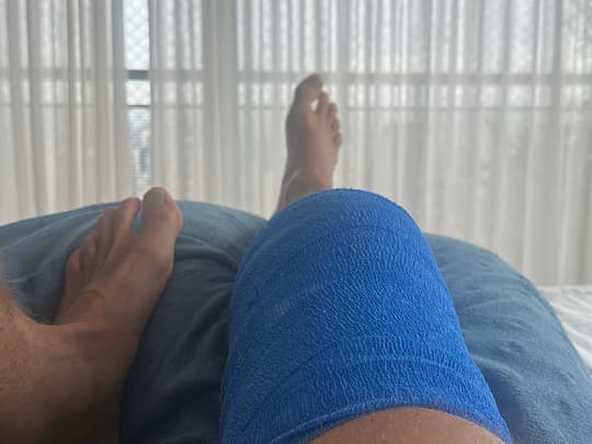 Foto do progresso no dia 1 da recuperação do joelho