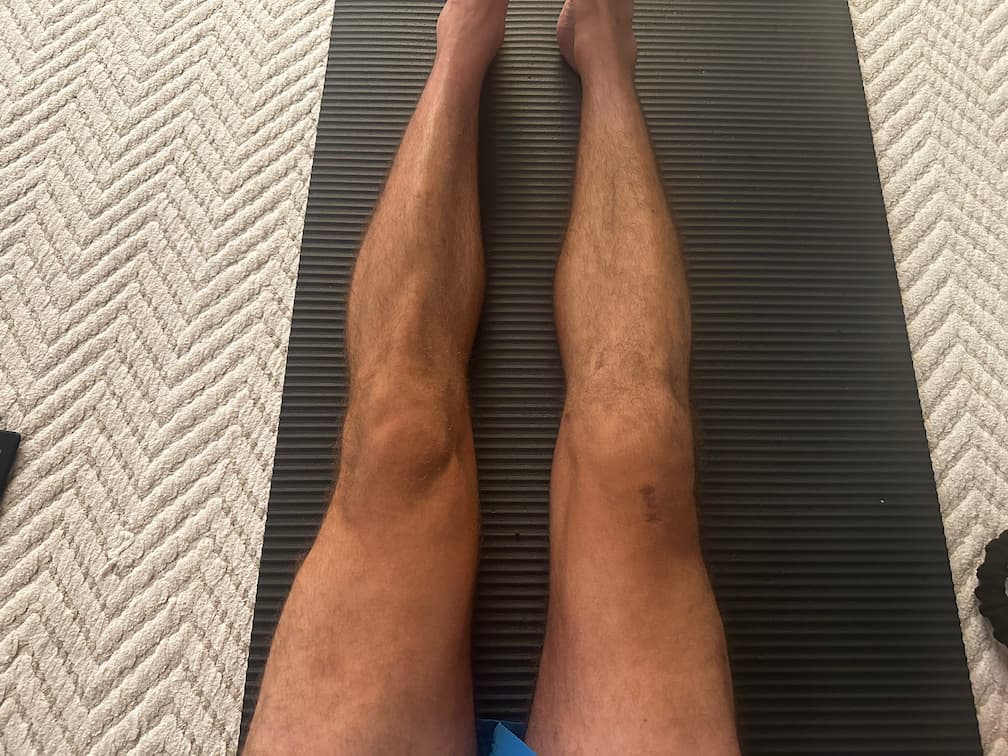 Dia 110 da recuperação do joelho