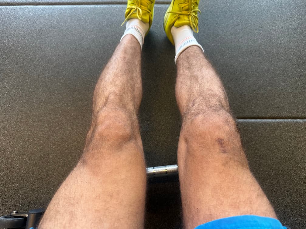 Dia 113 da recuperação do joelho