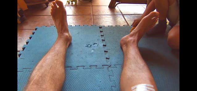 Foto do progresso no dia 13 da recuperação do joelho