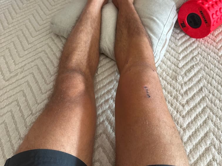 Foto do progresso no dia 20 da recuperação do joelho