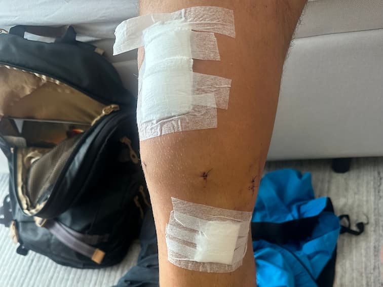 Foto do progresso no dia 4 da recuperação do joelho