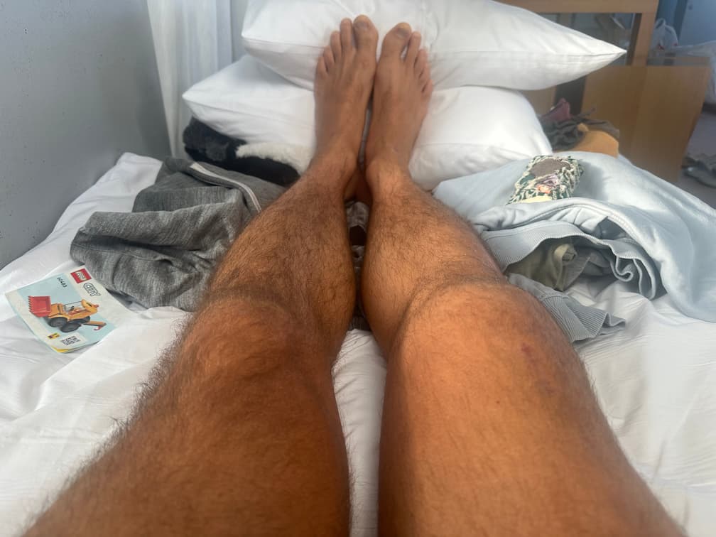 Foto do progresso no dia 57 da recuperação do joelho, durante a viagem