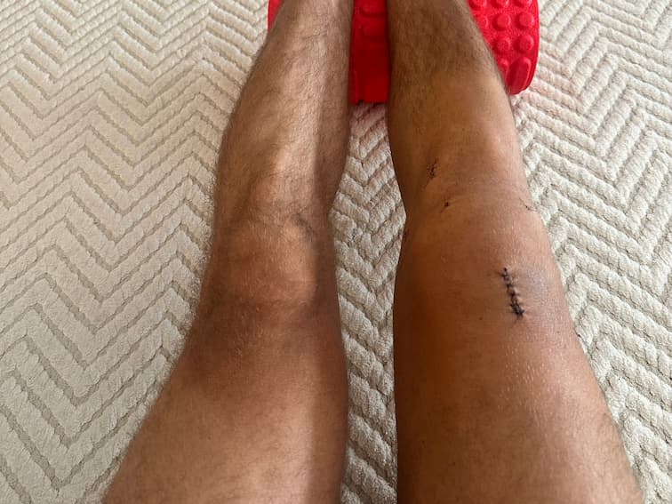 Foto do progresso no dia 7 da recuperação do joelho