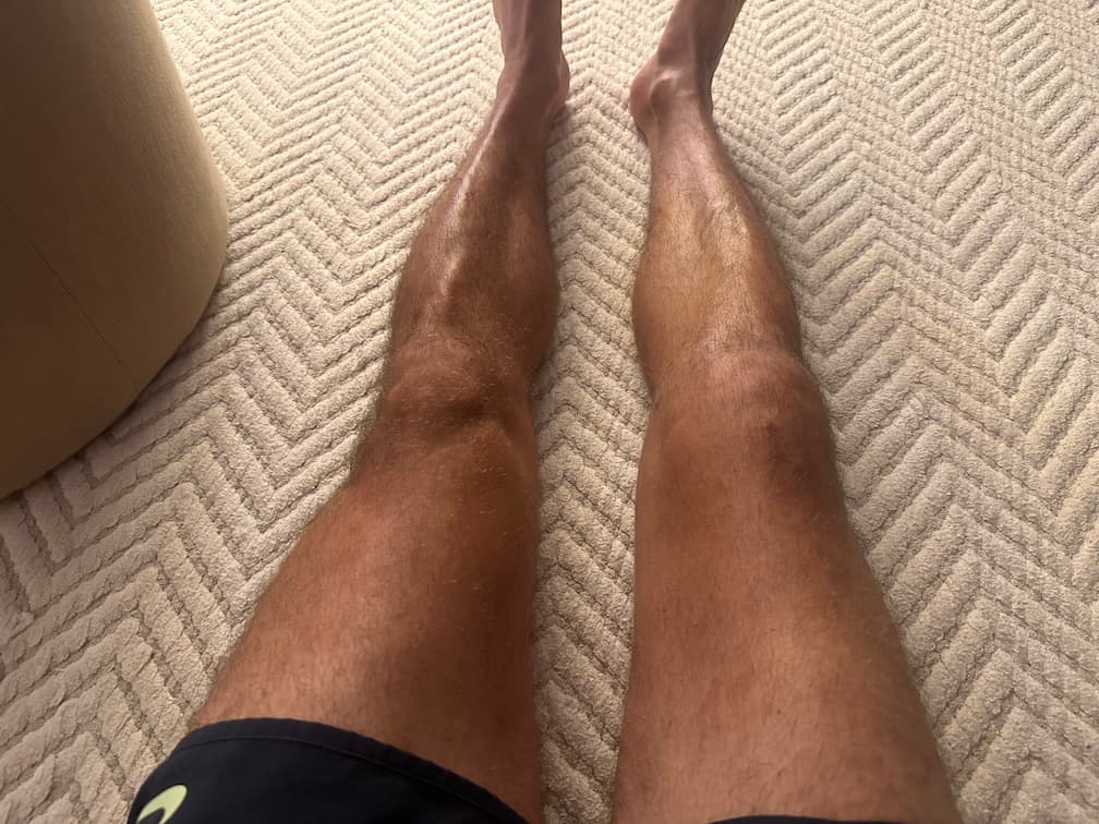 Progresso da recuperação no dia 75