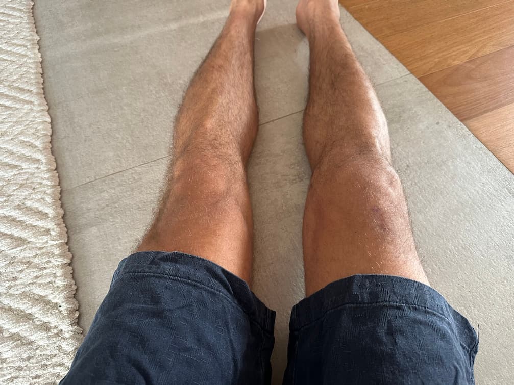 Progresso da recuperação no dia 77