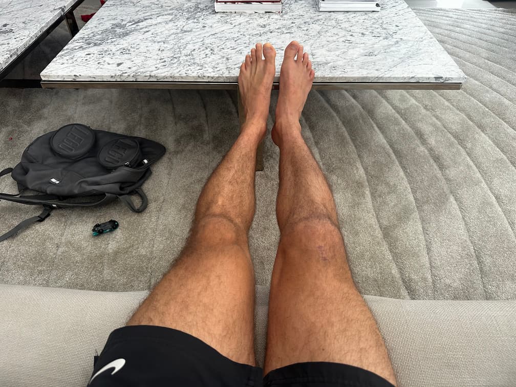 Progresso da recuperação no dia 83