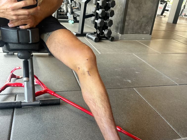 Foto do progresso no dia 9 da recuperação do joelho